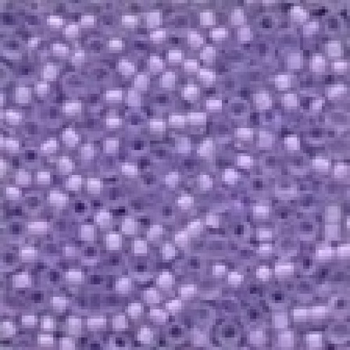 Frosted Beads